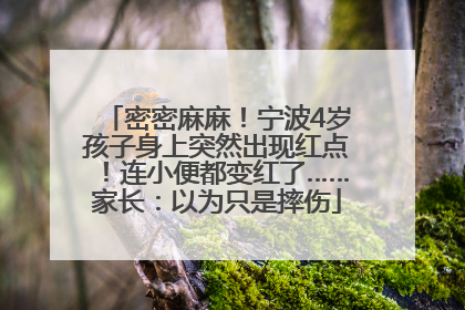 密密麻麻！宁波4岁孩子身上突然出现红点！连小便都变红了……家长：以为只是摔伤